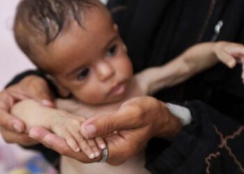 "أطباء بلا حدود": أطفال غزة يموتون جوعًا وسط استمرار الحصار الإسرائيلي وغياب الاستجابة الدولية