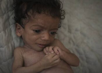 بريطانيا تفتح أبوابها لعلاج أطفال غزة