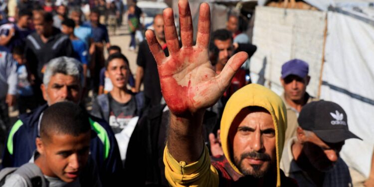 A Palestinian man shows blood stains on his palm after he carried casualties among people seeking aid supplies from the U.S.-backed Gaza Humanitarian Foundation, in Khan Younis, in the southern Gaza Strip, May 29, 2025. REUTERS/Hatem Khaled TPX IMAGES OF THE DAY